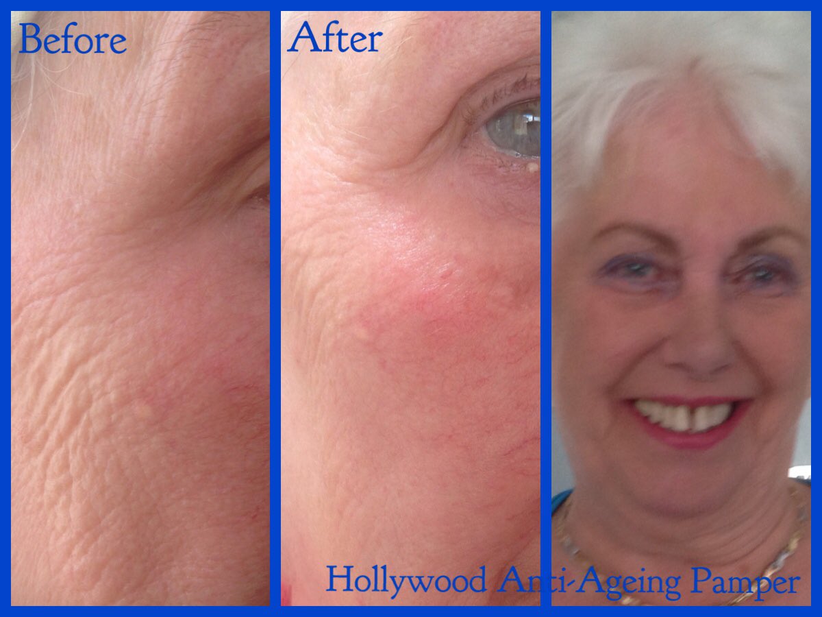 Top Kat Wellness tweet media