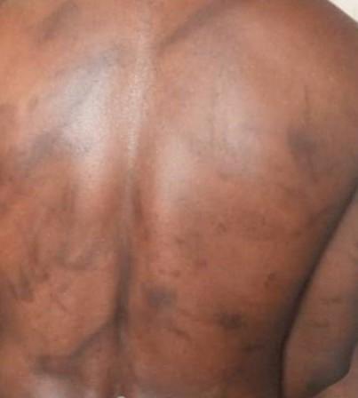 LewisMudge's tweet photo. State security agents in #Cameoon are torturing without fear of repercussions. It’s time for the UN Security Council to act and send a clear message the world is watching. @hrw https://t.co/odWLDUaXoj https://t.co/MwynlWwVu2