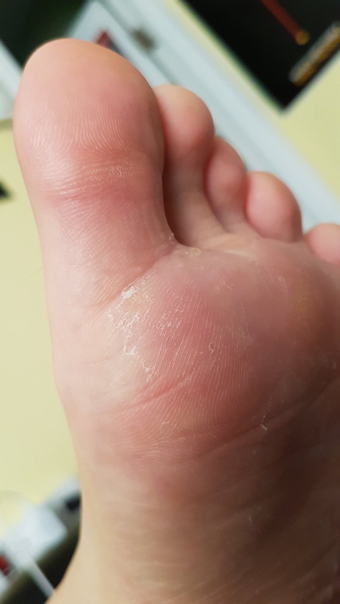 CadMtl's tweet photo. This morning im blessing you with #macrophilia and crusting #alphafeet π£
Youre welcome boy. Now crawl to them. π
#findom #Cashmaster #cashslaves #FootMaster #alpha #paypig #humanatm #gayfindom #cashslave #cashfag #
alphafoot #alphapic https://t.co/7CM0U7oVs8