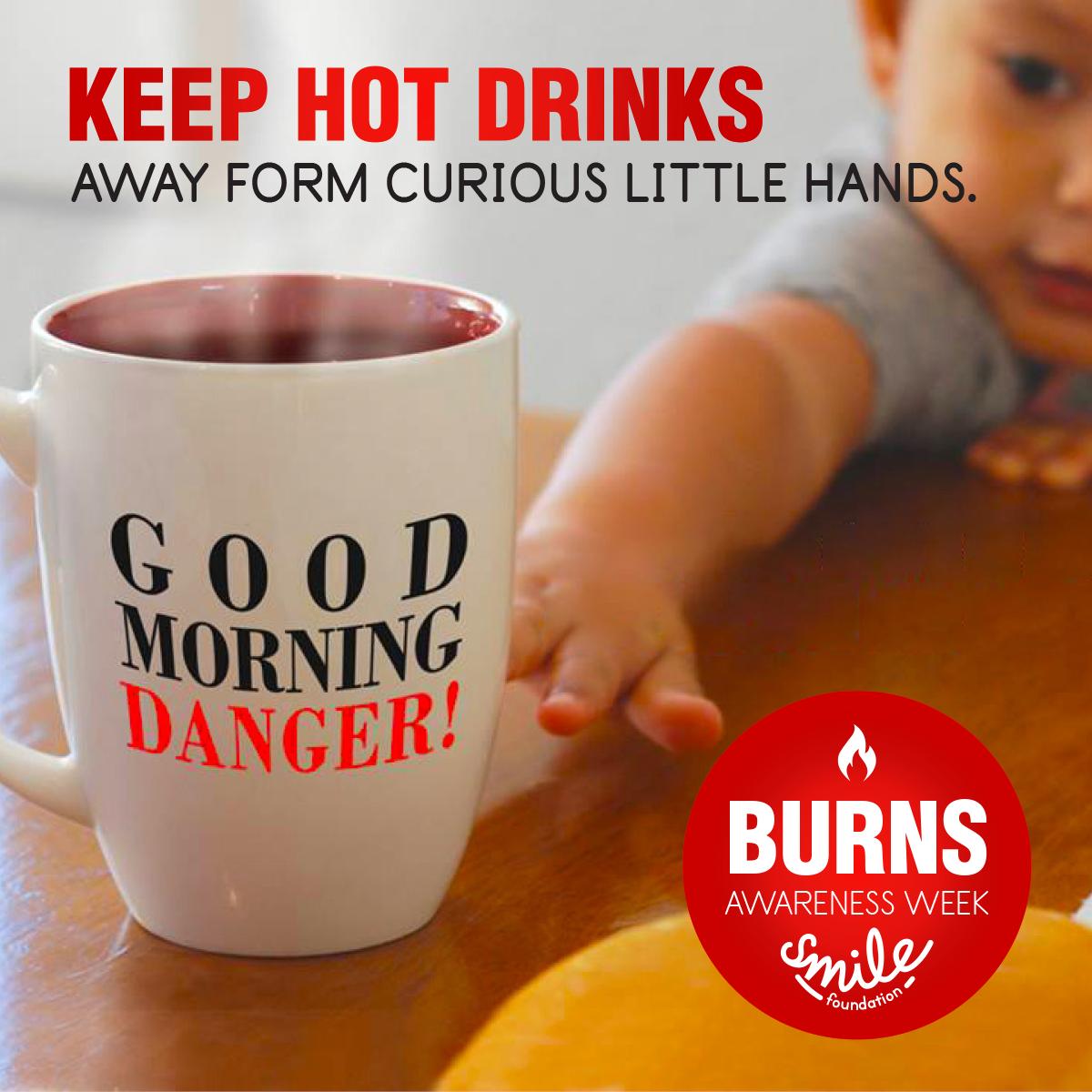 SmileFundSA's tweet photo. National Burns Awareness Week starts today...remember to make safety your first priority #burnsweek #burnsawareness #preventionisbetterthancure #savelives #safetyiscool https://t.co/790hj0qenv