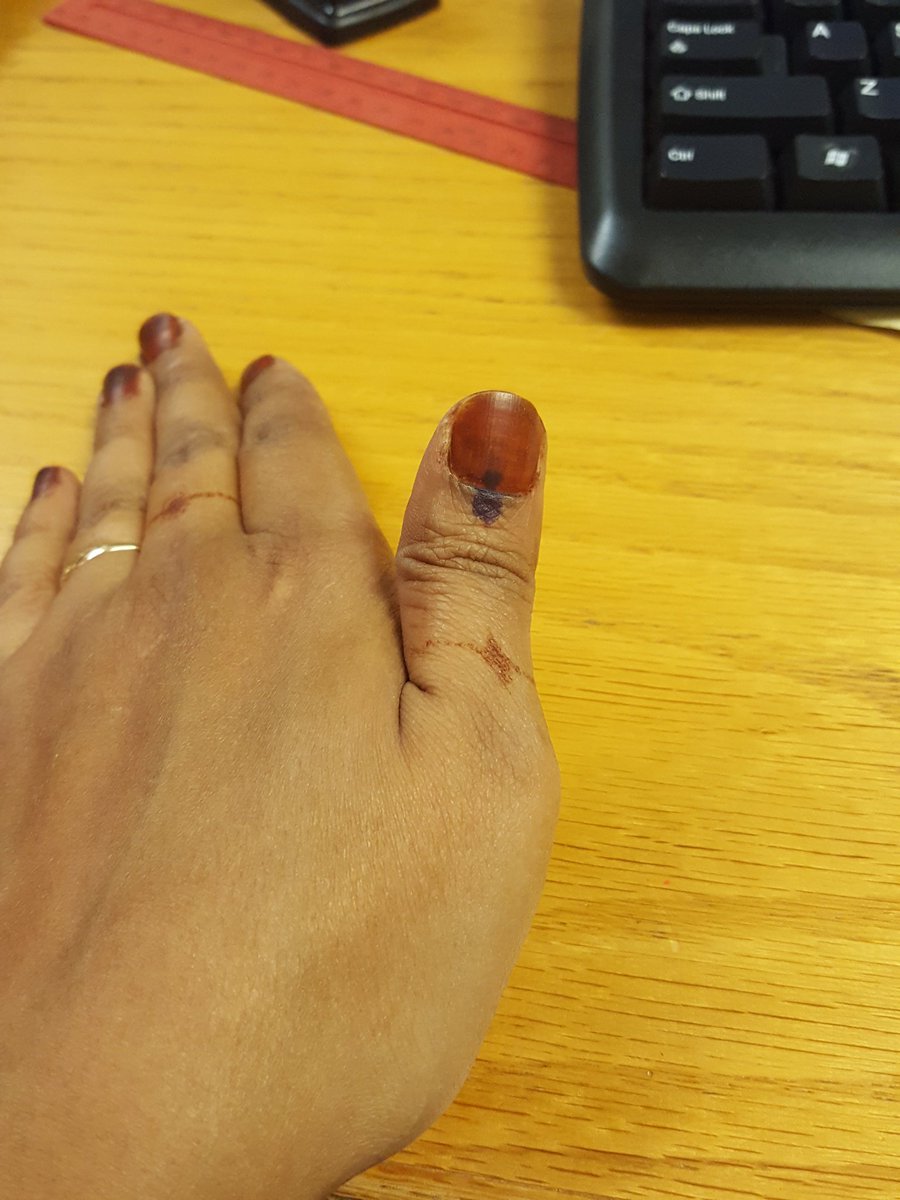 N_adamk's tweet photo. @MYANC Done. https://t.co/Fs5ML0DHQE