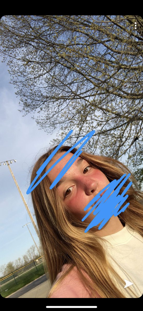 k_robinette_AMS's tweet photo. over the weekend i went to gavins baseball games and didn’t put sunscreen on and got a little burnt!! #AMSweekendupdate https://t.co/TLmlRPu07x
