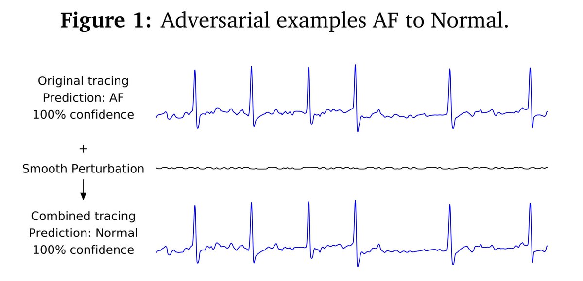 calimagna's tweet photo. We show you can create adversarial examples that fool SOTA deep learning arrhythmia classifiers of single-lead EKG signals. Come check out our demo today at 4.20pm at #ICLR2019 Debugging ML Systems Workshop! Joint work of @evidation and NYU https://t.co/gaRLs0wPJ9