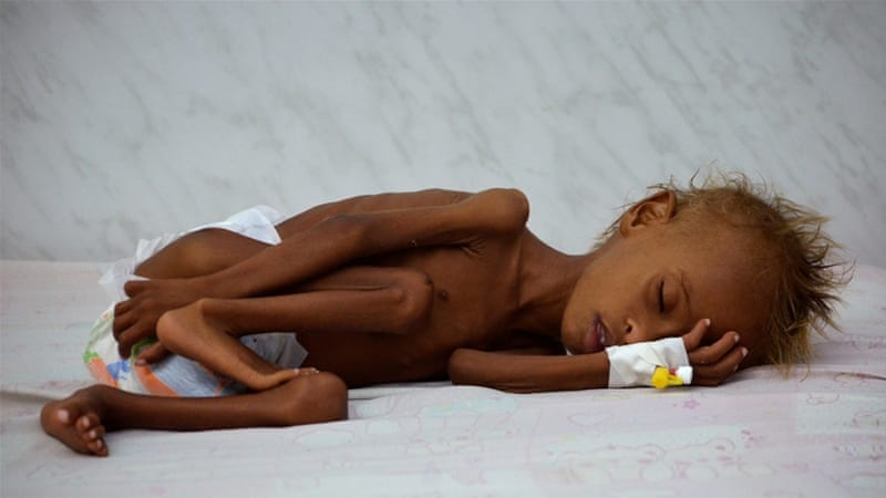 Whilst the world obsesses over the #RoyalBaby, millions of other babies will starve to death in #Yemen due to #UK support of #SaudiArabia's war against that country.

Oh well -- suppose I'm just being a downer!

<a href="/Rachael_Swindon/">Rachael Swindon</a> <a href="/a_leesha1/">Aleesha</a> <a href="/AhmadAlgohbary/">Ahmad Algohbary</a> <a href="/SamWalton/">Sam Walton</a> <a href="/Muqadaam/">Nadeem Ahmed</a>