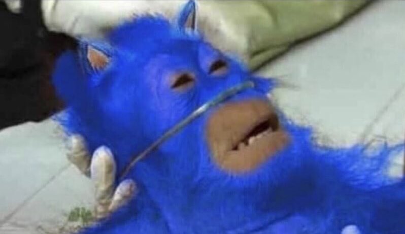 Sonic the Hedgehog after a head on collision with a bus