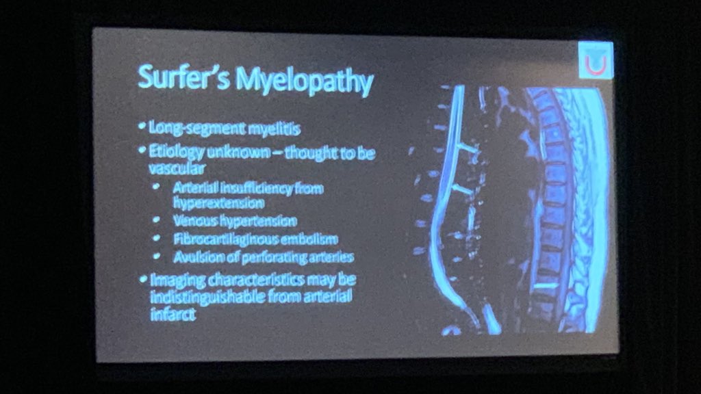 nakoontz's tweet image. @lubdha_shah dropping knowledge about #SpineRad compartment-based DDx, #mnemonics, abbreviated imaging protocols, AND topical diagnoses like #SurferMyelopathy — you should be here! #ARRS19 @UofUNeuro