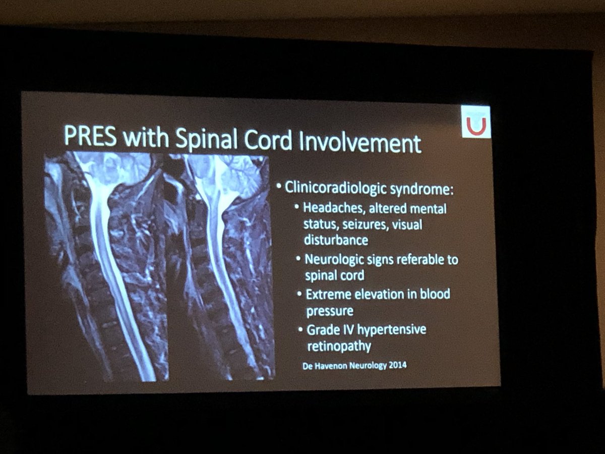 Miriam_Peckham's tweet image. Wait a second, PRES can involve the cord?😳 Gray matter more involved in the cord than what is seen in the brain. Nice case @lubdha_shah #ARRS2019 @ARRS_Radiology #spine #SpineRad #neuro #UofUSpine