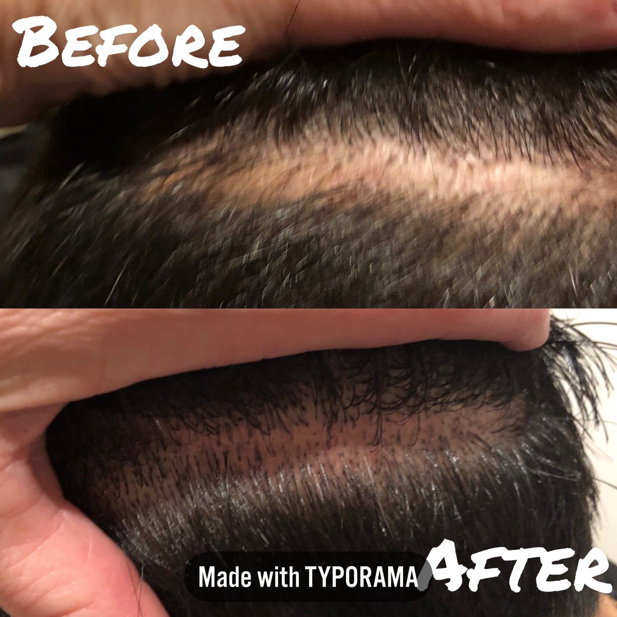 VizonaryBizBldr's tweet image. So here’s my first #MicroScalpPigmentation attempt on a client. Definitely harder than it looks but once I was feeling more confident, it all started coming together. Pretty proud of my first try and looking forward to getting better! #NeverTooOldToLearn #MetroForMen #LakeForest