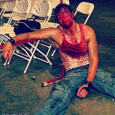 Bruised and Bloodied, but wouldn’t have it any other way.