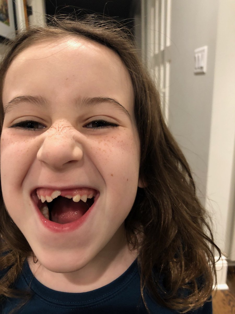 chibabybliss's tweet photo. Finally lost the nasty tooth where the other one was practically in. I pulled it myself but my parents better save for braces. https://t.co/FpOYYDw6re