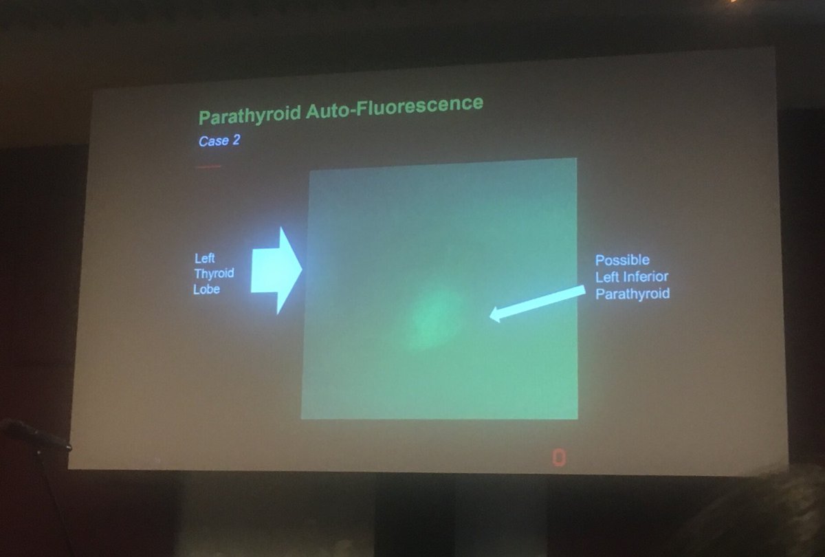 How to use #fluorescence to improve outcomes for #parathyroidsurgery @drewshirleymd #RACS19