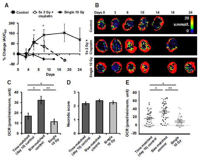 Dr_ASalem's tweet photo. Proud to have led this work with James O'Connor et al showing:
1. Novel OE-MRI can detect &amp; track #hypoxia in #lungcancer
2. OE-MRI is feasible &amp; repeatable
3. &amp; can detect ⬇️ #hypoxia after #Radiotherapy
= OE-MRI (✔️validated) CAN BE USED IN FUTURE TRIALS
https://t.co/idiPB5ZEK6 https://t.co/bFtwKtFI2G