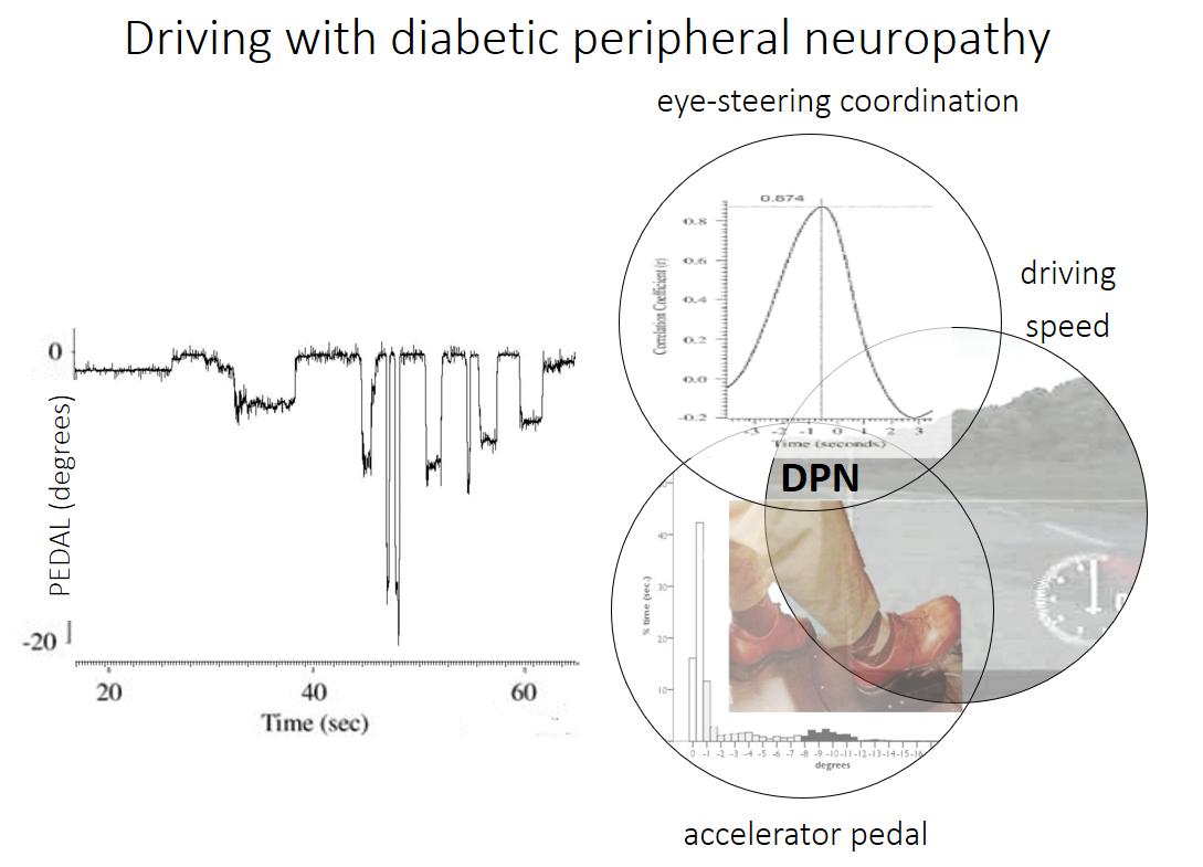 Dilwyn Marple-Horvat (@dilmh) on Twitter photo Our paper on the impact on driving of diabetes-related nerve damage is out & available open access from <a href="/DiabeticMed/">Diabetic Medicine</a> here onlinelibrary.wiley.com/doi/full/10.11β¦ 'Altered accelerator pedal control in a driving simulator in people with diabetic peripheral neuropathy'<a href="/MonicaDiabR/">Monica Perazzolo</a> #diabetes Our paper on the impact on driving of diabetes-related nerve damage is out & available open access from <a href="/DiabeticMed/">Diabetic Medicine</a> here onlinelibrary.wiley.com/doi/full/10.11β¦ 'Altered accelerator pedal control in a driving simulator in people with diabetic peripheral neuropathy'<a href="/MonicaDiabR/">Monica Perazzolo</a> #diabetes