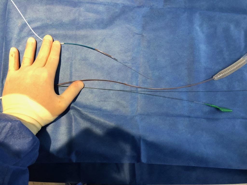 Jimmy Kerrigan (@kerrigjl) on Twitter photo Just finished a tough coronary brachytherapy case with <a href="/tavrkapadia/">Samir Kapadia</a>; we'd previously found that the 3.5F Beta-Cath is not 6F Guideliner compatible (7F was fine). Bench tested a 6F Guidezilla II post-case (wire = Sion Blue); it works! <a href="/BSCCardiology/">BostonSci Cardiology</a> #CardioTwitter <a href="/CleveClinicCath/">Cleveland Clinic Cath Lab</a> Just finished a tough coronary brachytherapy case with <a href="/tavrkapadia/">Samir Kapadia</a>; we'd previously found that the 3.5F Beta-Cath is not 6F Guideliner compatible (7F was fine). Bench tested a 6F Guidezilla II post-case (wire = Sion Blue); it works! <a href="/BSCCardiology/">BostonSci Cardiology</a> #CardioTwitter <a href="/CleveClinicCath/">Cleveland Clinic Cath Lab</a>