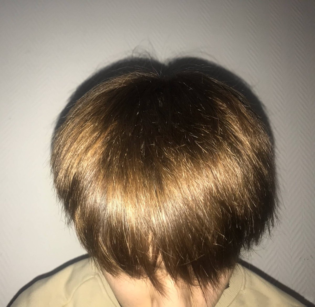 UNINE_Yangyang's tweet photo. 我将会把这些绷带扔的远远的～
#BandagesOnTheLawn[音乐] https://t.co/n4tJfj2DQt
