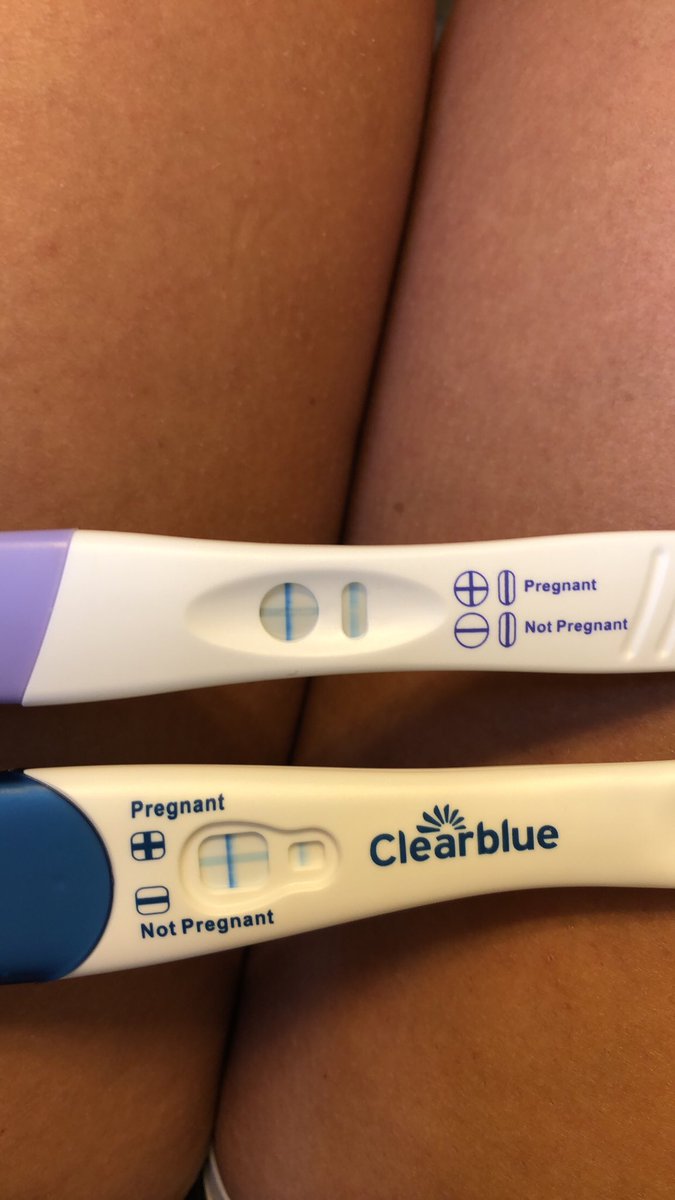 _carolinebelle_'s tweet photo. One year ago today I saw those scary blue lines. I was terrified. I was too young, too selfish, too afraid. And then 9 months passed. And I met my best friend, my mini me, my whole world. I love you more than life Adeline. You are my forever. 💕 #ChooseLife https://t.co/SGl168zqhi