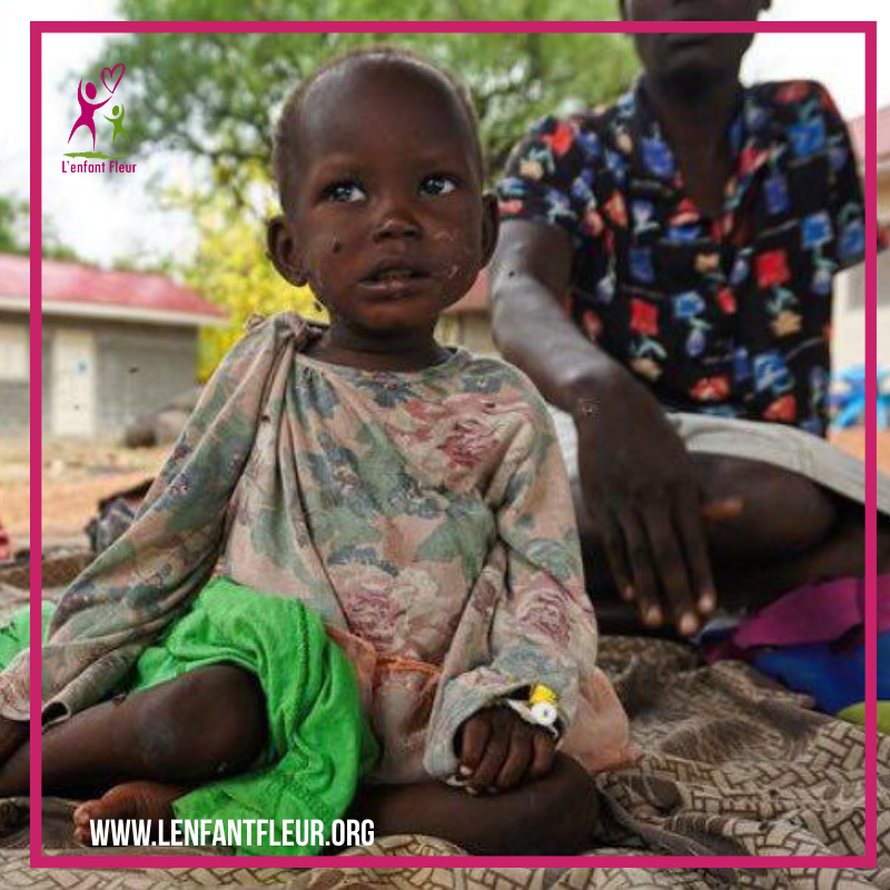 😇 Les enfants sont les premières victimes de la guerre 😇

#Recrute #êtrebénévole #Bénévolat #sansbutlucratif #association #enfant #action #devenir #membre #adhérents #Personne #syria #warinsyria #warcrimes #war #crimesagainsthumanity #humanrights #guerre