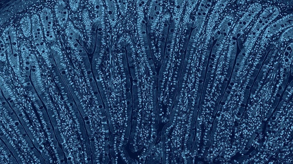 probioticflow's tweet image. Probiotics: Reiterating What They Are and What They Are Not
buff.ly/2XF2qpX  #probiotics  #definitionsmatter