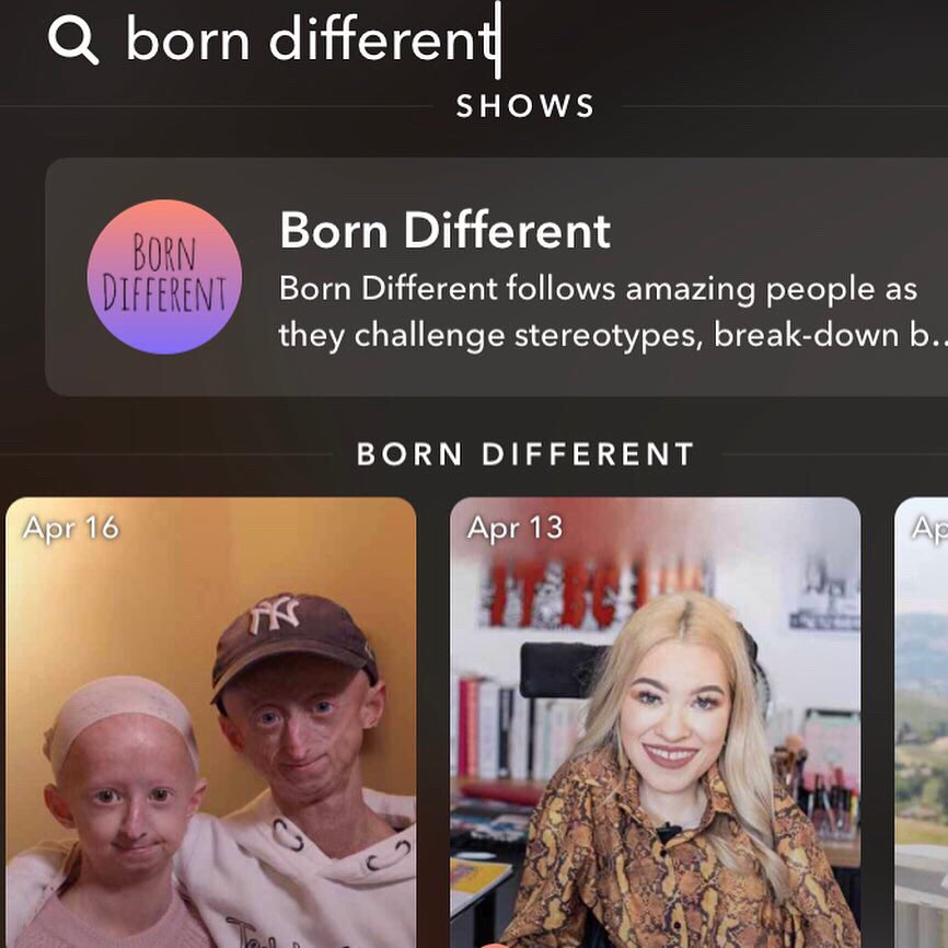 TenaciousTinyT's tweet photo. LIFE can be over in a SNAP! So make sure to follow @borndifferentshow to keep up with me some of the most amazing stories you will ever see!! SNAP TO IT!!! #snapchat #mystory #mylife #progeria #life #liveinthemoment #dancelife #perspective #empowerment #cbus #614artists https://t.co/hCkTuKJovV