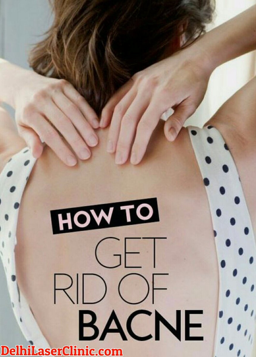 how to get rid of back acne