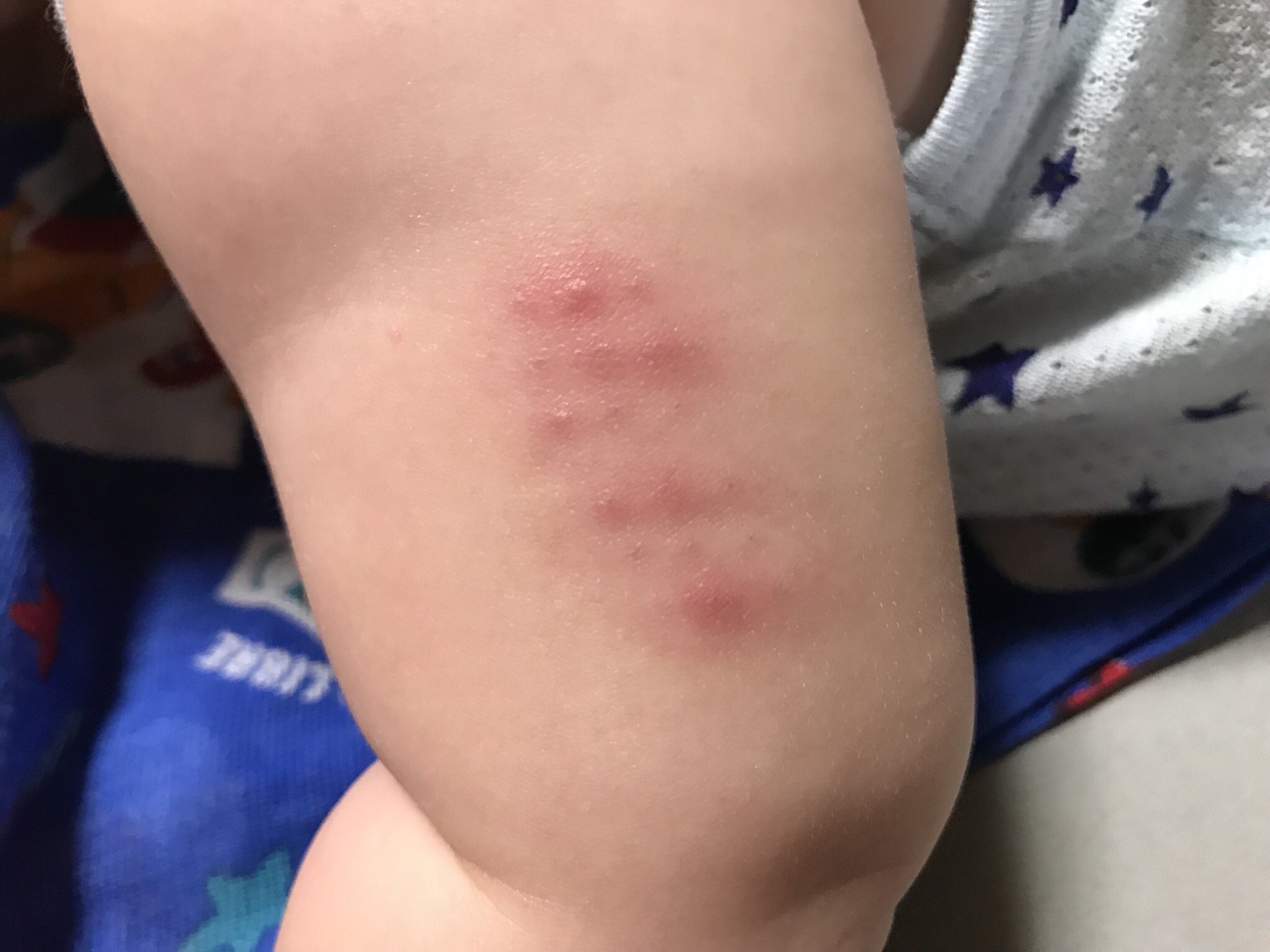 טוויטר Hiro בטוויטר gで泣く 注射じゃ泣かない男だったが gは見てる方もツライ 花山薫でも泣く痛さなんだろうなぁ g 予防接種 赤ちゃん 注射痛くて始めて泣いた 10本目ぐらいに初黒星 花山薫 T Co Yrkclinjml