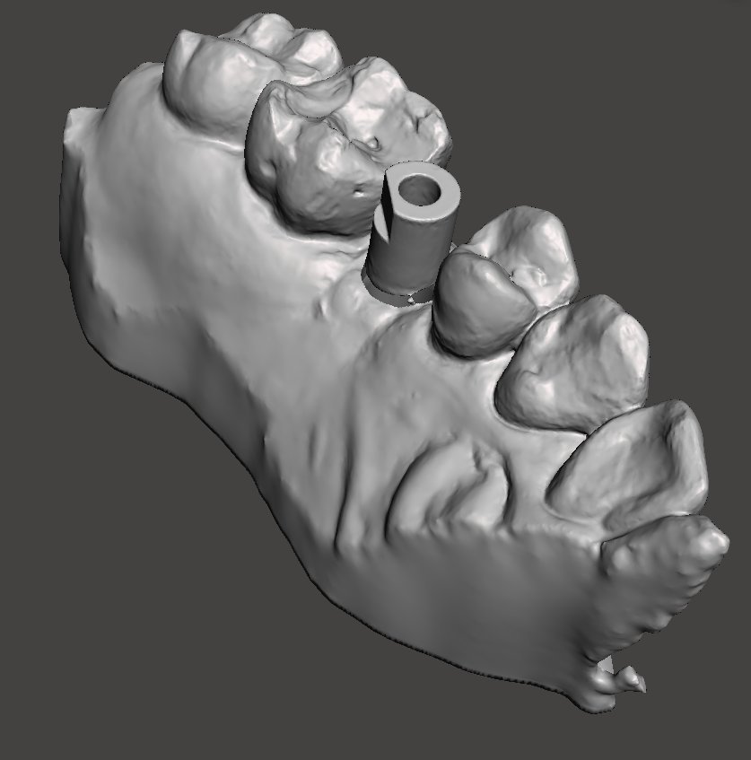 ortoreding_lab's tweet photo. Necesitas estereolitografiar un cuadrante para un DSI? Mándanos tu escaneado y nosotros nos ocupamos del resto! #impresion3D #implantesdentales #dental https://t.co/nf6JOVymtS