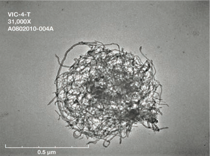 Stemcellmeet's tweet photo. Nanotechnology provides a new strategy for #RegenerativeMedicine to improve or restore damaged tissues. To know more join us @ https://t.co/6pvuuj4oFH  
#CellScience #Paris #Conference https://t.co/GDd5JXIzGj