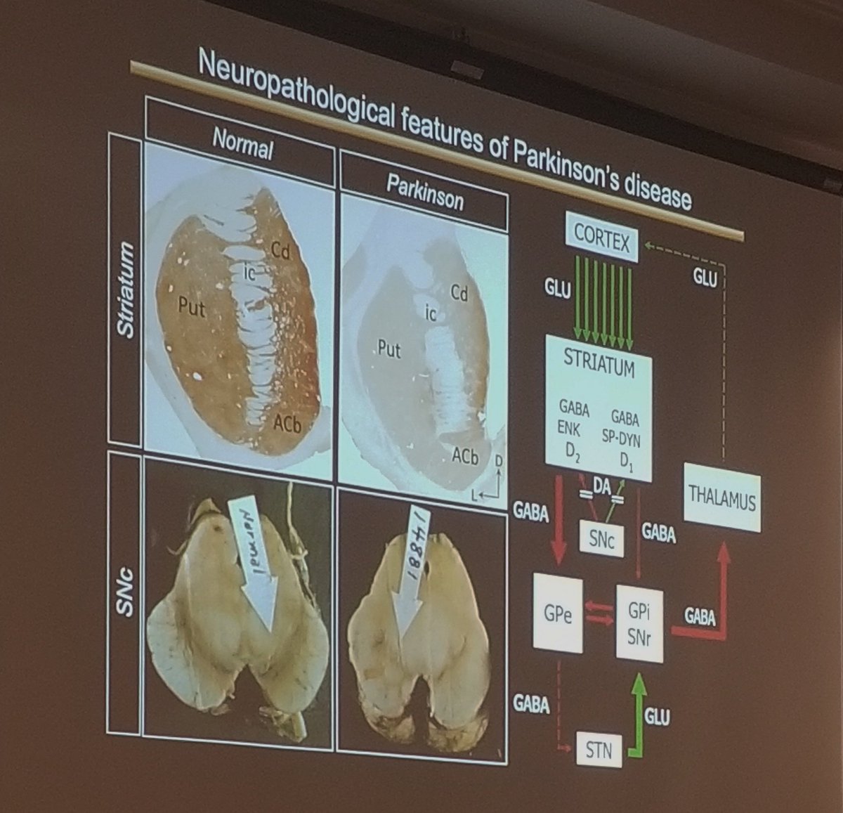 Our first invited speaker of the sat, Dr. Martin Parent of <a href="/CERVO_ULaval/">CERVO</a> presents his work on serotonergic and dopaminergic innervation in models of #Parkinsons in #asntr19 #neuroscience #pd #diseasemodeling