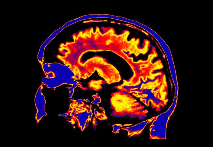 tferriss's tweet photo. "Imperial College London launches world’s first Centre for Psychedelics Research" https://t.co/Za7npvyy6k I'm very excited to be involved with this. https://t.co/lWM29mohZ7