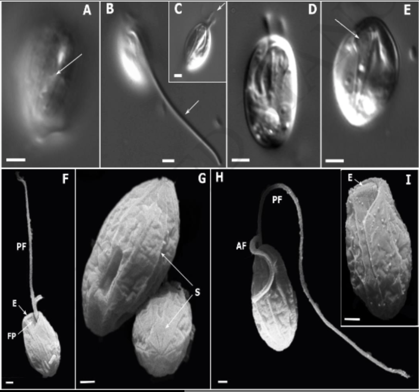 IVoltski's tweet photo. New phagotrophic #euglenids from #DeepSea https://t.co/c6C3ZJxi6y
#protist https://t.co/FOutiKcjTe