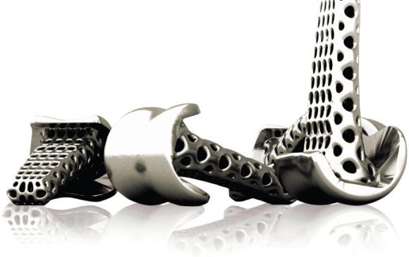 Zukunft Medizintechnik: Heilen und Leben retten mit 3D-Druck buff.ly/2GANq6L