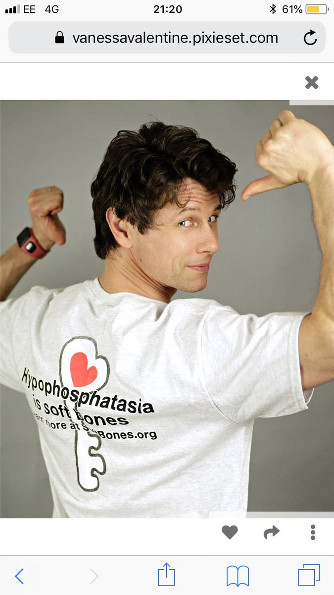 Softbonesuk's tweet image. One more sleep until the #LondonMarathon2019 😱 @ockenden_leon now has his number. We are so excited for Leon who has now smashed 1k 🙌🙌🙌 Enjoy your rest today we are all behind you 🏃‍♂️🏃‍♂️🏃‍♂️🏃‍♂️👏👏👏💪💪💪 It’s still not too late to support Leon.  justgiving.com/crowdfunding/L…