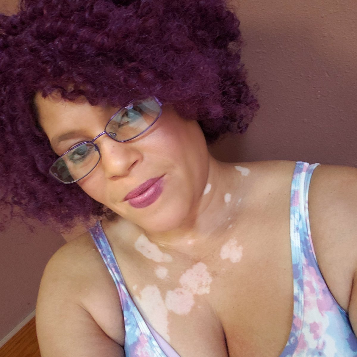 dapurplediva's tweet photo. @GlobalVitiligo we in this 2gather #TeamVitiligo #weAreVitiligans #VitiligoStrong #WillNotHideMyVitiligo https://t.co/FK5n129NEc