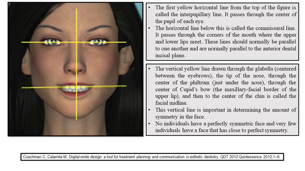AbdullahAlshoai's tweet photo. #Restorative
#Esthetic
#Smile_analysis
Facial analysis: One of the most important analysis for the fabrication of wax-up, and final prosthesis. https://t.co/eTQZ6TmAD9