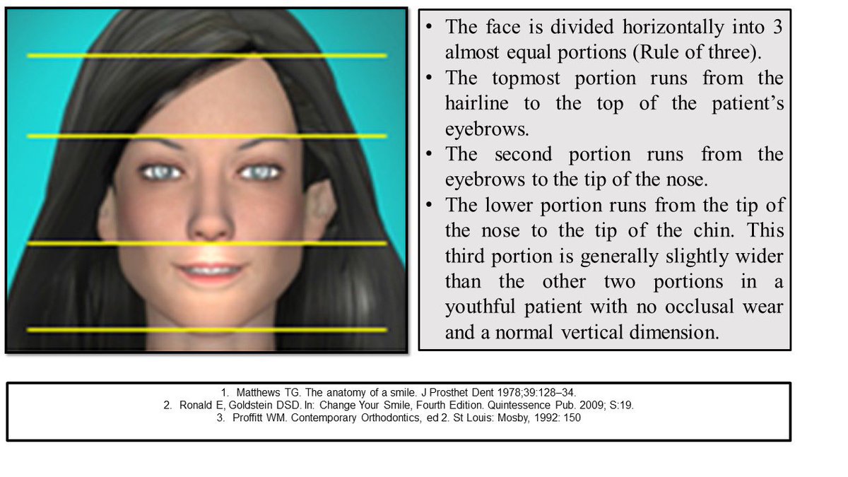 AbdullahAlshoai's tweet photo. #Restorative
#Esthetic
#Smile_analysis
Facial analysis: One of the most important analysis for the fabrication of wax-up, and final prosthesis. https://t.co/eTQZ6TmAD9