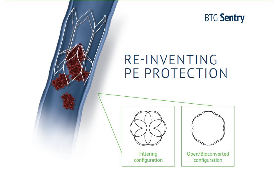 BTGVascular's tweet photo. Have you seen the World's First Bioconvertible IVC Filter? Stop by the BTG booth 301 to learn more. #BTGVascular #BTGSentry #IVC2019 #Miami #US https://t.co/rzhWkNowKK
