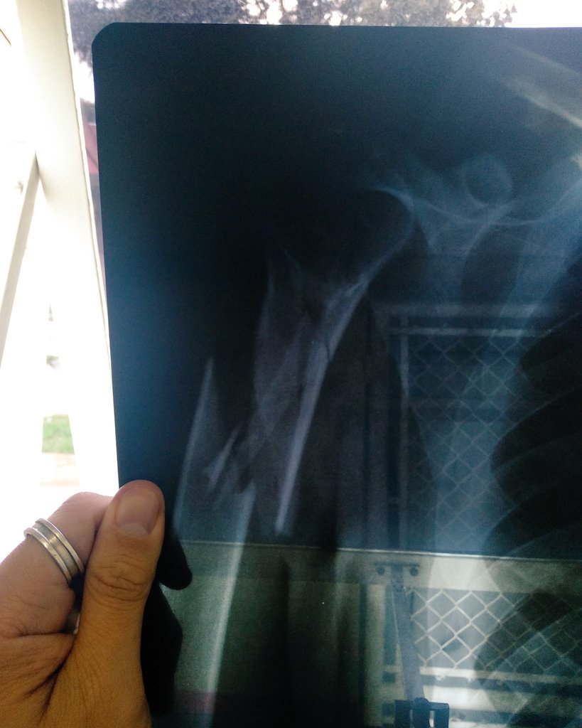 Dolor MSD hace 4 días...
Solo tomo té de manzanilla para ver si el dolor pasaba.

Así no gente... Así no.