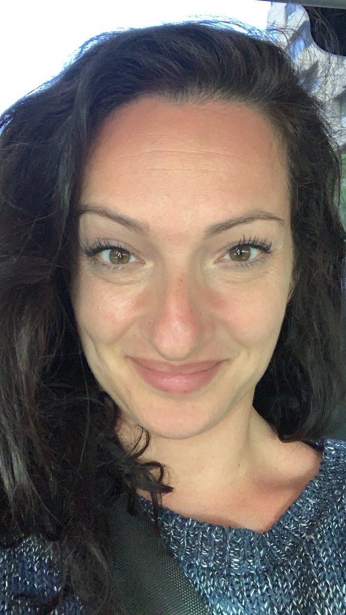 Thank you <a href="/acc_madrid/">ACC Madrid</a> for this special afterglow. For all the love, all the energy, all the smart conversations &amp; my sunburn, which I’ve got during a session. Another takeaway which will remember me of our wonderful time. :) And thanks for the safe space. #accmadrid #accmad