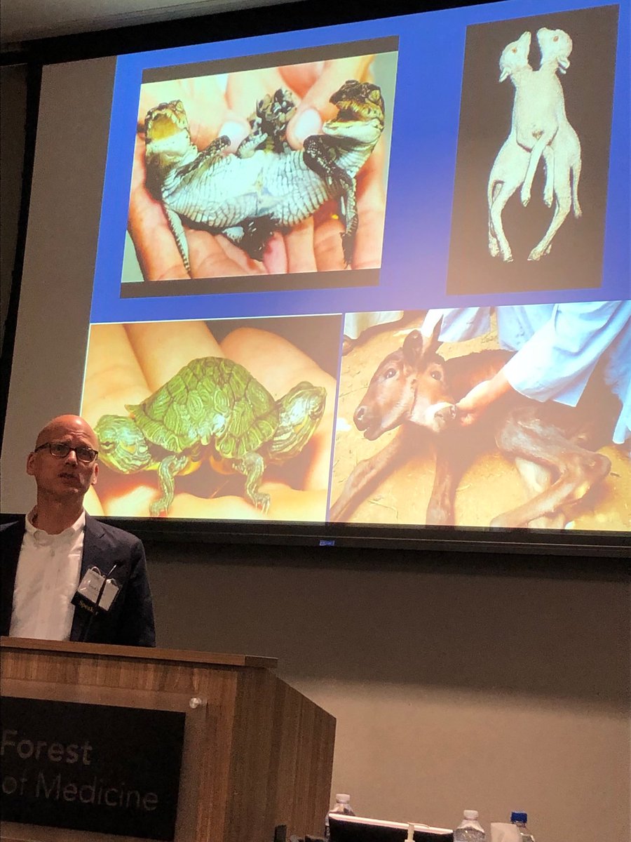 PedsAnes (@pedsanes) on Twitter photo Fascinating discussion on #conjoinedtwins by Dr Eck <a href="/Duke_Anesthesia/">Duke Anesthesiology</a> #pedsanes #pedsanes19 Fascinating discussion on #conjoinedtwins by Dr Eck <a href="/Duke_Anesthesia/">Duke Anesthesiology</a> #pedsanes #pedsanes19