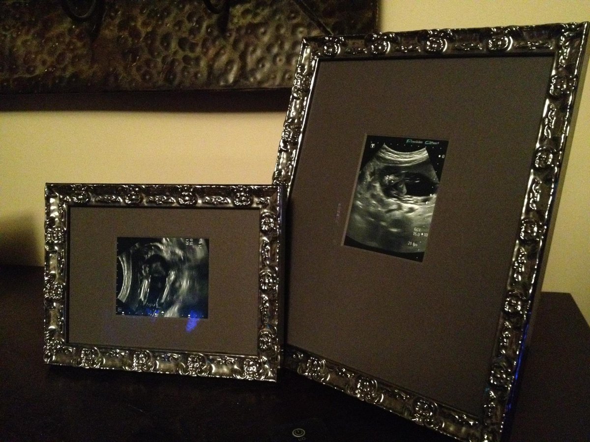 ArtSoulFraming's tweet photo. Motherโs Day is creeping up. Treasure the moments when everything became so real โค๏ธ
#mothersdaygifts #yll #shoplocalyll #smallbusiness #shoplocal https://t.co/lomresp9jB