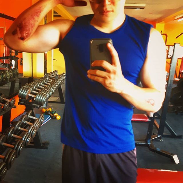 phworkoutjp's tweet image. Good thing is that the scar gone. 
Thank you for my immune system 😎

#japanese #philippines 
#bodybuilding #fit #train #sport #gym #fitnessmodel #motivation #cleaneating #getslim #foodblogger #energydiet #fitnessmotivation #energyslim #fitlife #prilaga #weightlossstory #fitn…