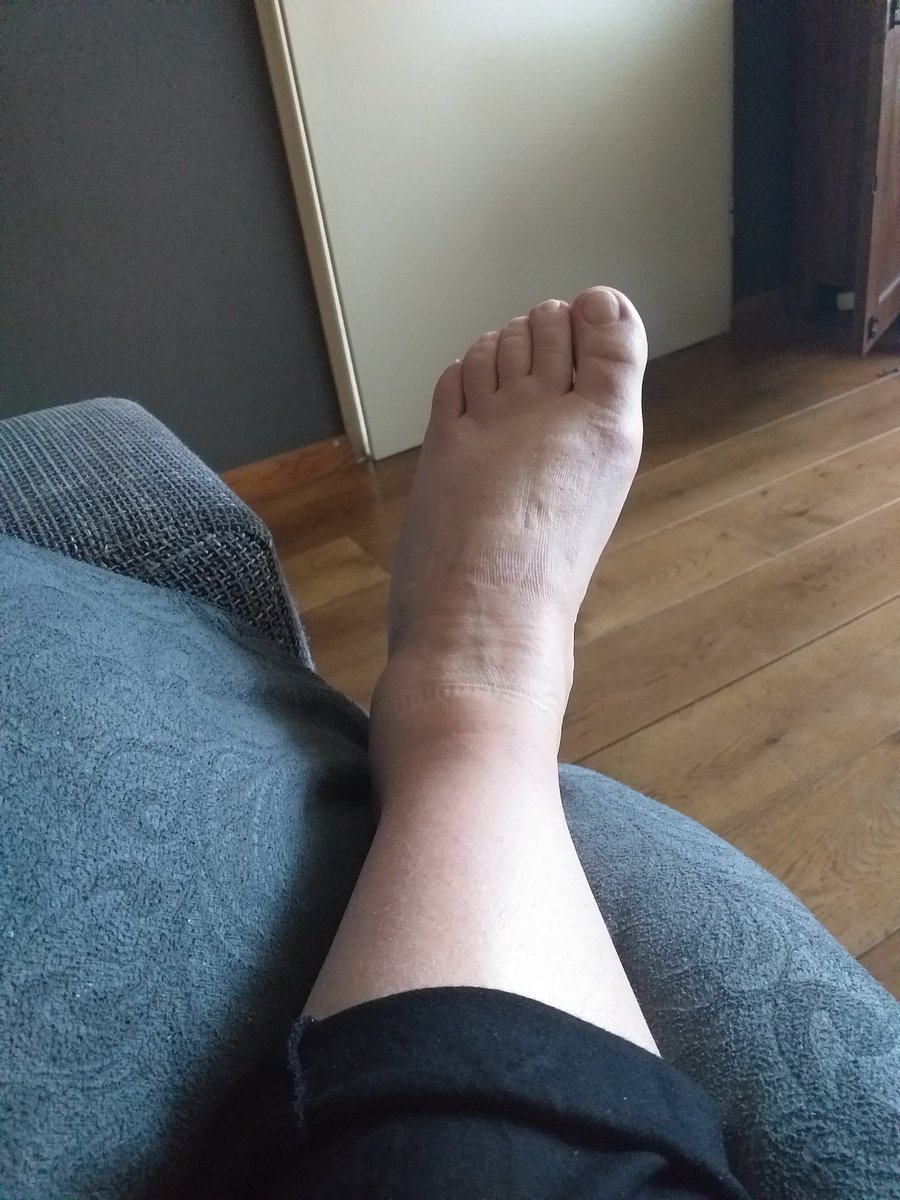 Zit je dan met je been in de lucht 😣