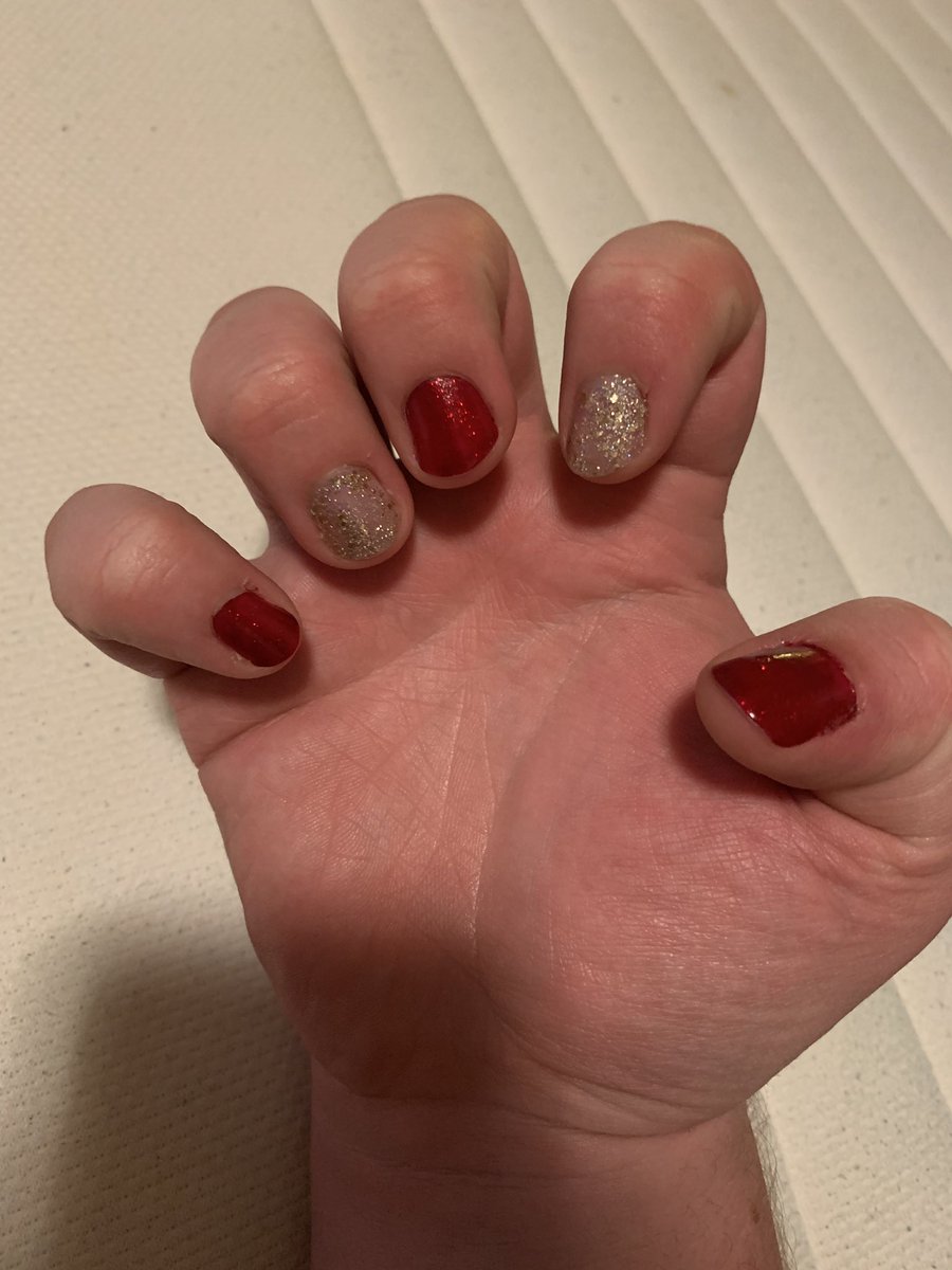 JacobCWard's tweet photo. Look at my gorgeous nails! #ChinaGlaze #RubyPumps #CountingCarats https://t.co/lnpIFbWwxL