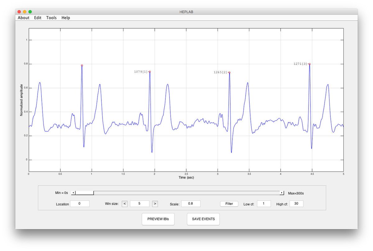 Check out HEPLAB, my new #matlab toolbox for the preprocessing of the heartbeat-evoked potential. Automatic detection and manual edition of R and T ECG waves. Can be used as an #eeglab extension or standalone application. #opensource #opensoftware

github.com/perakakis/HEPL…