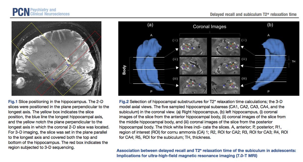 A new article has been published! 'Association between delayed recall and T2* relaxation time of the subiculum in adolescents: Implications for ultra‐high‐field magnetic resonance imaging' by Jeon et al. onlinelibrary.wiley.com/doi/10.1111/pc…
#adolescent #ultrahighfield #MRI #hippocampus