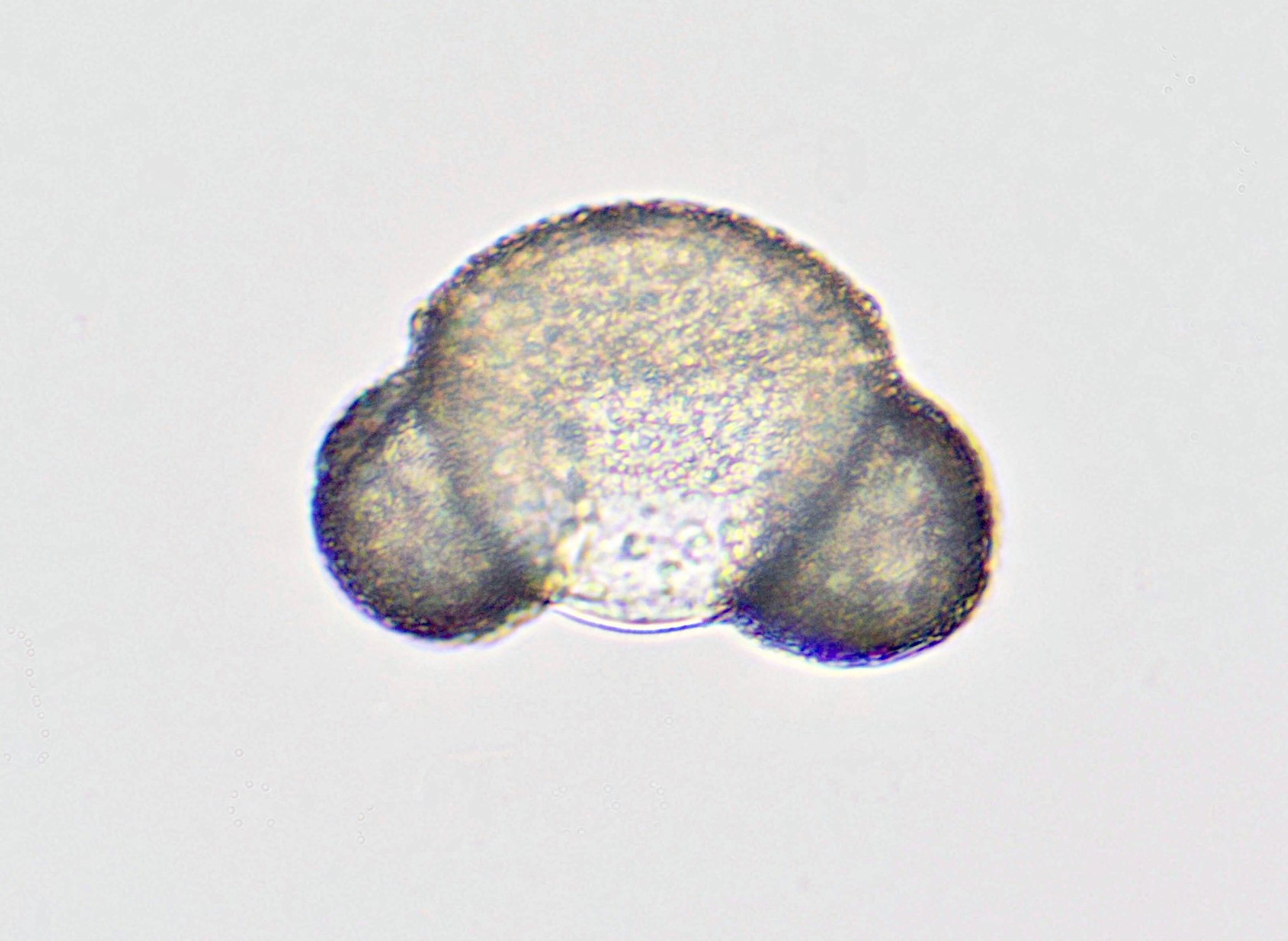 M31nebula マツの雄花が花粉 を飛ばしています 雄花はウロコのようなりん片が沢山集まってできていますが りん片の外側には葯が２個ずつ付いています 花粉には空気袋が2つ付いていて風で飛ばされやすくなっています 顕微鏡 マツ 雄花 花粉 中学