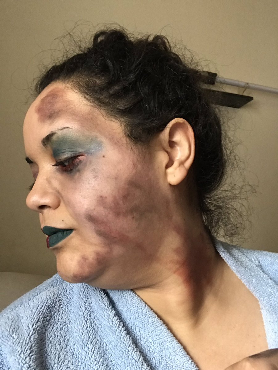 DeeliciousBeach's tweet photo. So, this is #me. This is my outside. Given I have #fibromyalgia #lupus #whalers danlossyndrome and #ptsd I’ve joined the #insideoutchallenge and tried to draw the inside. https://t.co/VK1LqfcDkM