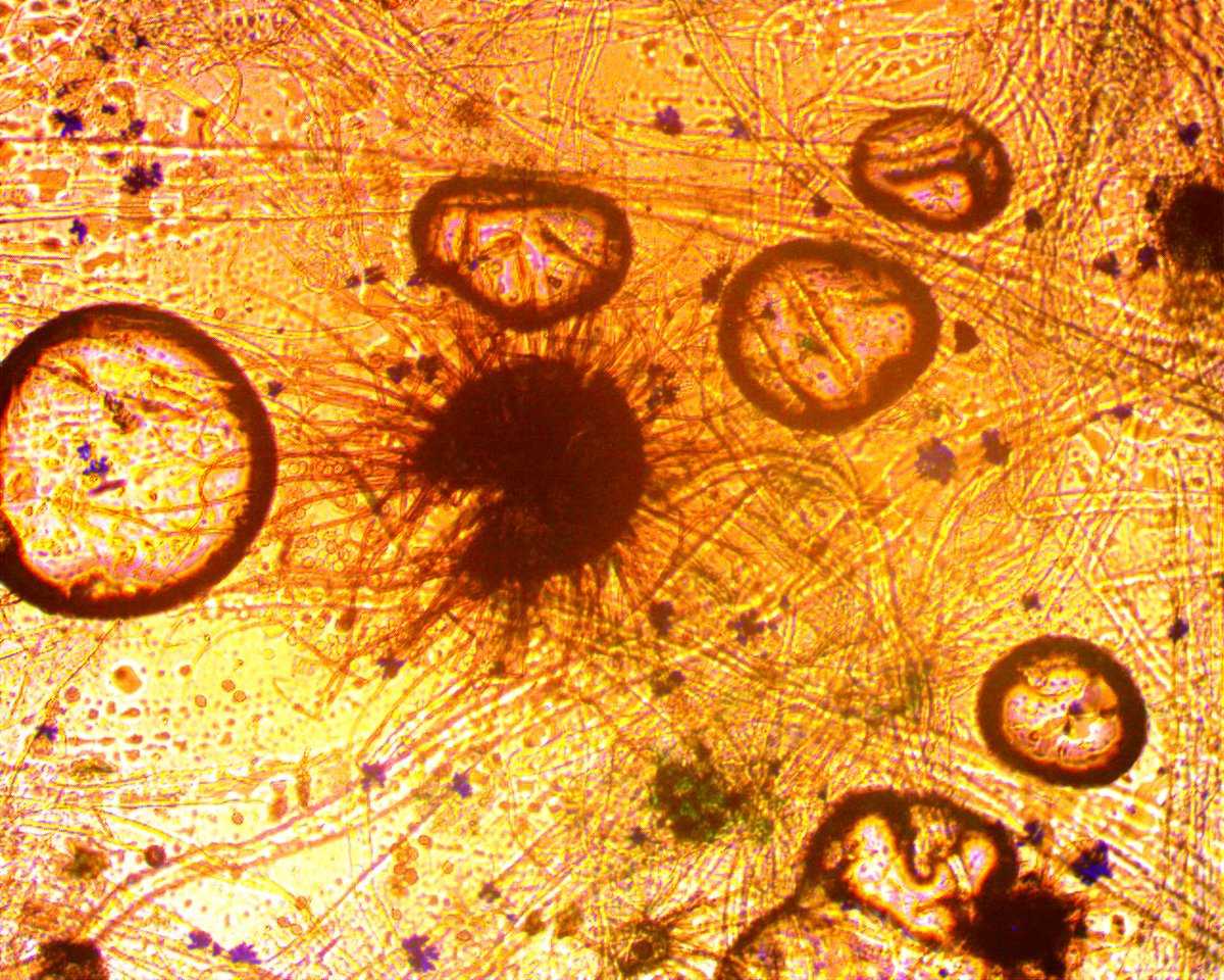 Come take #mold abatement courses with us! These training courses are perfect for contractors, workers, building inspectors and planners bit.ly/2Ww2rg8 🔬#ecologics #ecologicstrainingintitute
