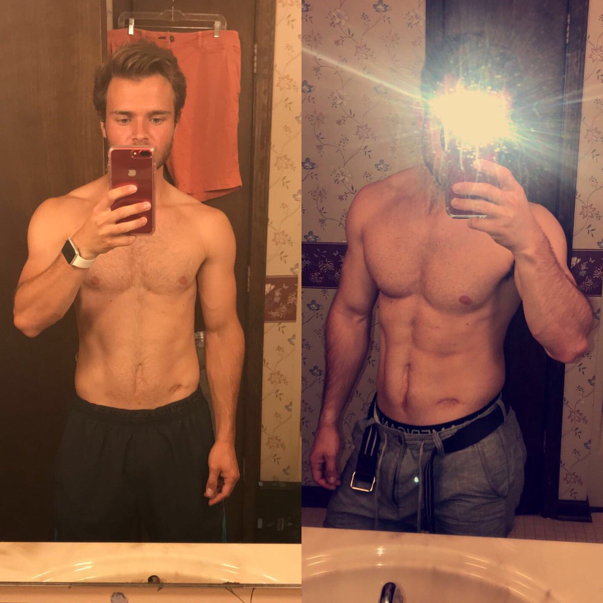 BradleyBatten's tweet photo. I struggle with my Crohn’s disease everyday but somehow I still find progress along the way. Never forget the reason you started #2yeartransformation https://t.co/ALIfpzZHPY