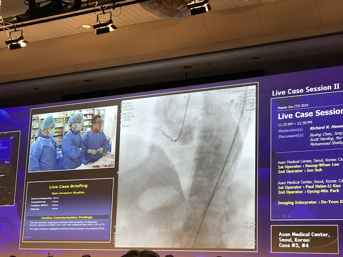 Live case session II at Asan Medical Center